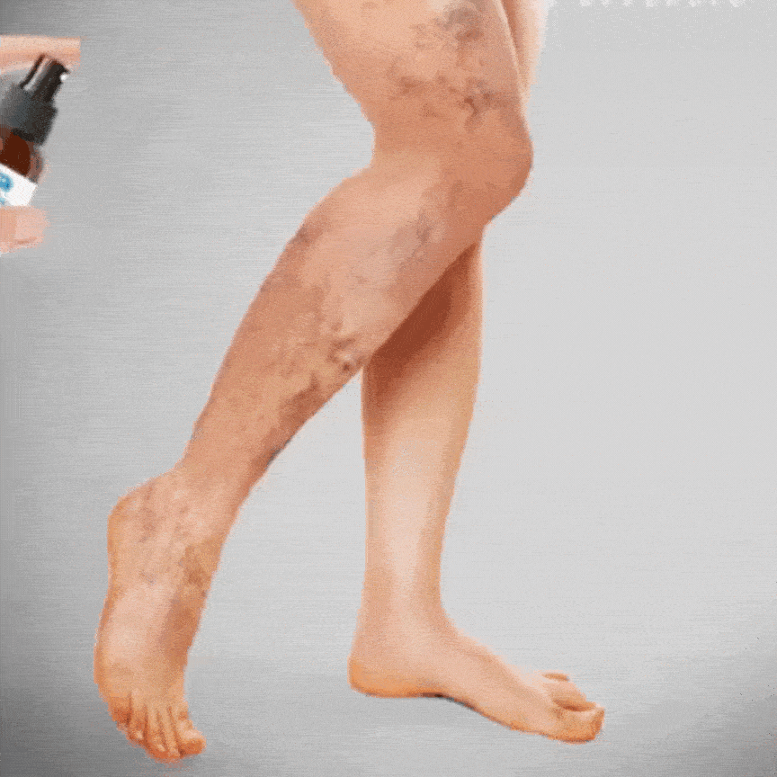 VitaliLeg Spray